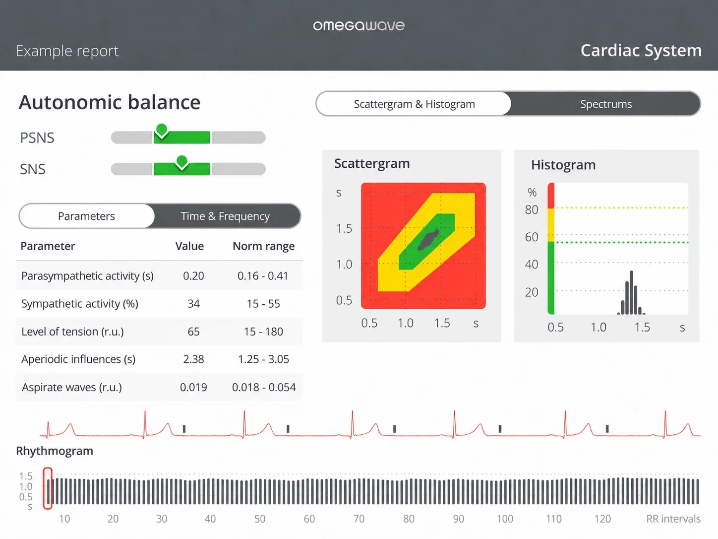Illustrative Omegawave autonomic balance results screen