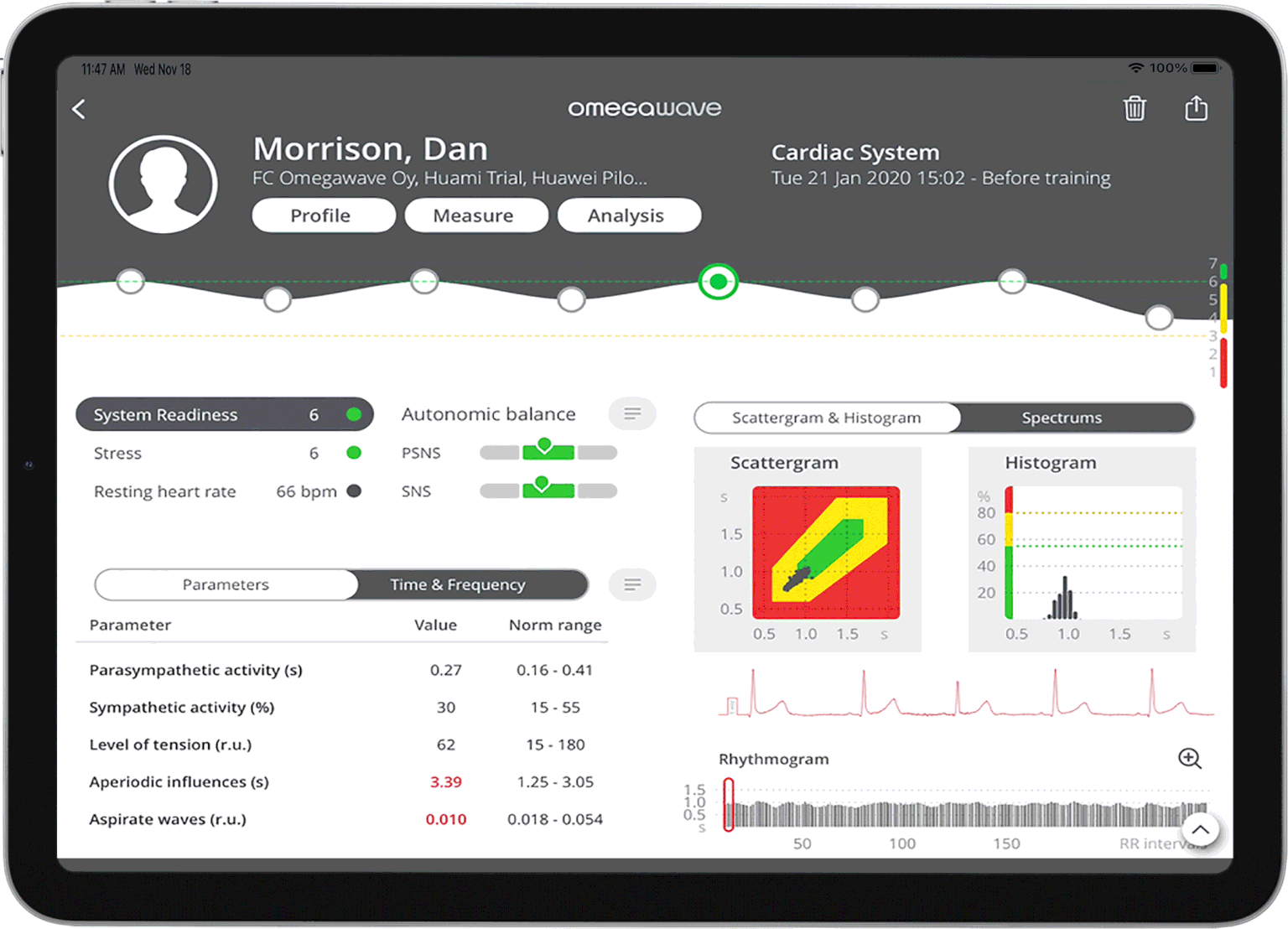 Vita Neu Cardiac System readout on iPad