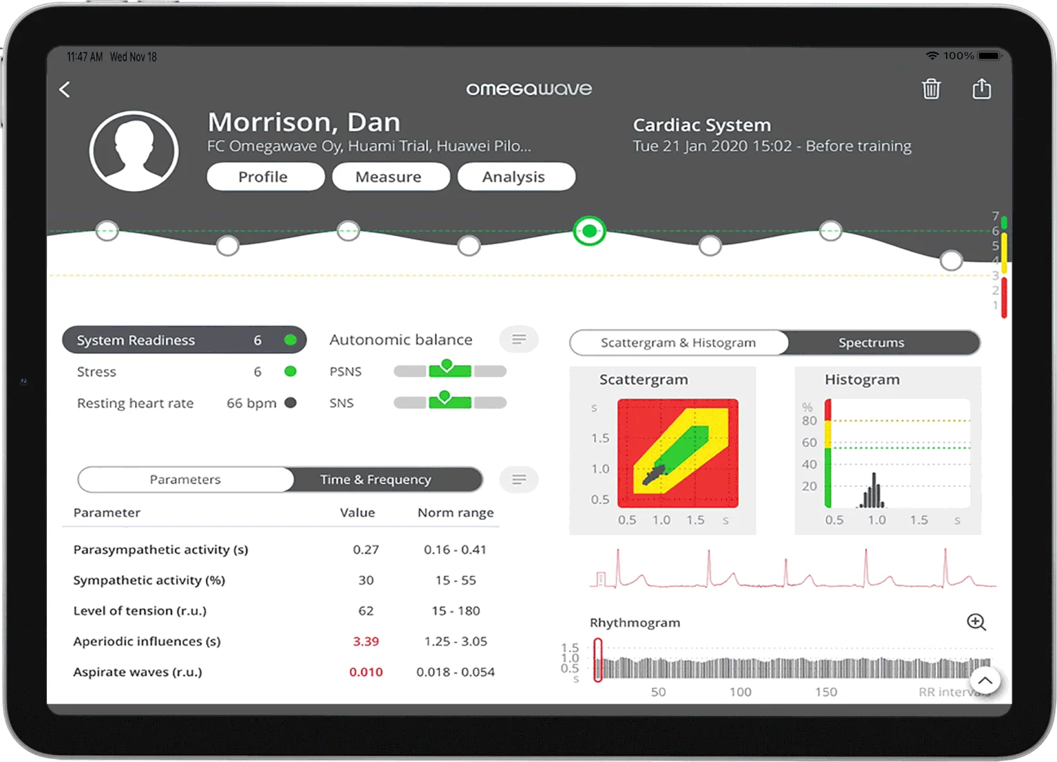 Vita Neu Cardiac System readout on iPad